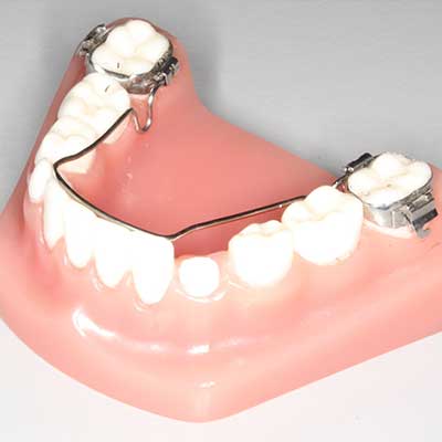 Orthodontic Emergencies | Bales Orthodontics | Santa Rosa and Novato CA